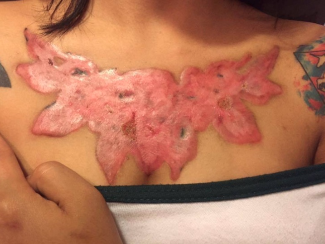 Riesgos en la piel al tatuarse - Agencia Peru